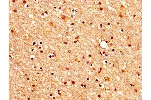IHC image of ABIN7160347 diluted at 1:400 and staining in paraffin-embedded human brain tissue performed on a Leica BondTM system. (CHRM3 抗体  (AA 253-492))