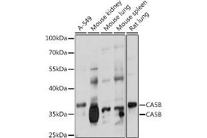Western blot analysis of extracts of various cell lines, using CB antibody (ABIN7266072) at 1:1000 dilution. (CA5B 抗体  (AA 1-317))