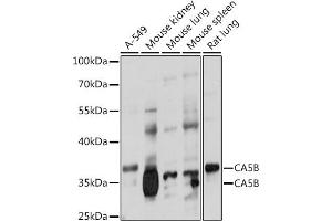 Western blot analysis of extracts of various cell lines, using CB antibody (ABIN7266072) at 1:1000 dilution. (CA5B 抗体  (AA 1-317))