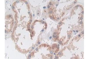 Immunohistochemistry (IHC) image for anti-ATP Binding Cassette Transporter A3 (ABCA3) (AA 1358-1635) antibody (ABIN7435553)