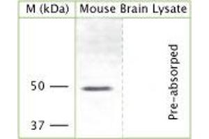 Western Blotting (WB) image for anti-Potassium Inwardly-Rectifying Channel, Subfamily J, Member 12 (KCNJ12) (Cytoplasmic Domain) antibody (ABIN350390)