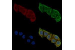 ABIN6259466 and ABIN6275441 staining Hela cells(45 min of heat-shock) by IF/ICC.