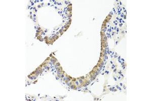 Immunohistochemistry of paraffin-embedded mouse lung using TTR antibody (ABIN3021473, ABIN3021474, ABIN3021475 and ABIN6215107) at dilution of 1:100 (40x lens). (TTR 抗体  (AA 21-147))