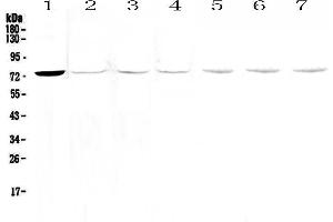 Western blot analysis of Tec  using anti-Tec  antibody . (NR4A3 抗体)