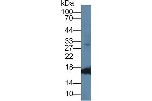 Western Blot; Sample: Caprine Cerebrum lysate; Primary Ab: 1µg/ml Rabbit Anti-Ovine MYO Antibody Second Ab: 0. (Myoglobin 抗体  (AA 1-154))