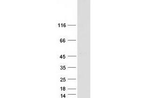 Validation with Western Blot