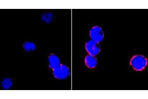 Confocal immunofluorescence analysis of BCBL-1 cells (left) and L1210 cells (right) using CD18 mouse mAb (red). (Integrin beta 2 抗体)