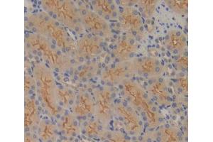 IHC-P analysis of kidney tissue, with DAB staining. (FPGS 抗体  (AA 210-439))