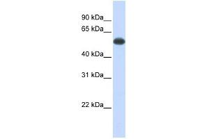 PPP3CA antibody used at 1 ug/ml to detect target protein. (PPP3CA 抗体)