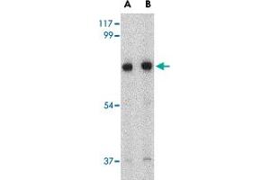 Western blot analysis of HAP1 in mouse brain tissue lysate with HAP1 polyclonal antibody  at (A) 0. (HAP1 抗体  (Internal Region))