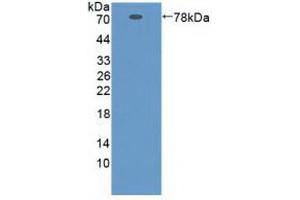 Western Blotting (WB) image for anti-serpin Peptidase Inhibitor, Clade A (Alpha-1 Antiproteinase, Antitrypsin), Member 10 (SERPINA10) (AA 24-444) antibody (ABIN7434527)