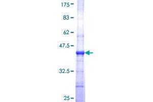 PLVAP Protein (AA 51-150) (GST tag)