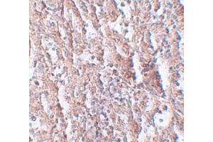 Immunohistochemistry (IHC) image for anti-Solute Carrier Family 39 (Metal Ion Transporter), Member 5 (SLC39A5) (Middle Region) antibody (ABIN1031181) (SLC39A5 抗体  (Middle Region))