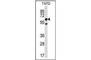 Western blot analysis of SCP2 Antibody (N-term) Cat. (SCP2 抗体  (N-Term))