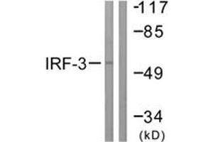 Western blot analysis of extracts from K562 cells, using IRF3 (Ab-385) Antibody. (IRF3 抗体  (AA 351-400))