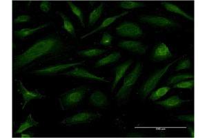 Immunofluorescence of monoclonal antibody to EIF1AY on HeLa cell. (EIF1AY 抗体  (AA 31-120))
