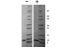 SDS-PAGE (SDS) image for Chemokine (C-X-C Motif) Ligand 10 (CXCL10) protein (ABIN6699674)