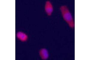 Immunofluorecence staining of GPC3 polyclonal antibody  on HepG2 cells . (Glypican 3 抗体  (Internal Region))