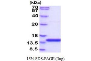 SDS-PAGE (SDS) image for Cystatin B (Stefin B) (CSTB) (AA 1-98) protein (His tag) (ABIN666707) (CSTB Protein (AA 1-98) (His tag))