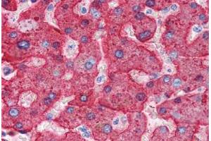 Human Liver (formalin-fixed, paraffin-embedded) stained with APOH antibody ABIN337313 at 2. (APOH 抗体)