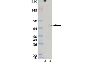 Western blot analysis of KIM-1 (human), mAb (3F4) : Lane 1: MW marker, Lane 2: HeLa, (cell lysate) , Lane 3: CaKi-2 (cell lysate). (HAVCR1 抗体)
