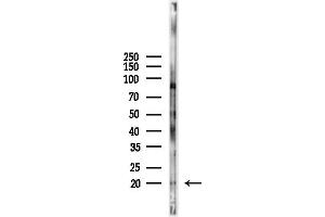 anti-Ribosomal Protein L35 (RPL35) (C-Term) antibody