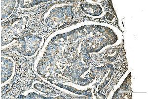 IHC analysis of CD9 using anti-CD9 antibody (ABIN7600001).