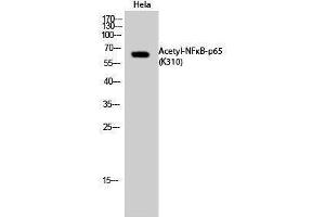 Western Blotting (WB) image for anti-Nuclear Factor-kB p65 (NFkBP65) (acLys310) antibody (ABIN3181877) (NF-kB p65 抗体  (acLys310))