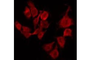ABIN6267494 staining Hela by IF/ICC. (SREBF1 抗体  (pSer439))