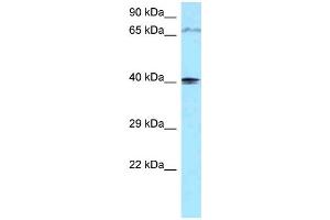 WB Suggested Anti-PIP5KL1 Antibody Titration: 1. (PIP5KL1 抗体  (C-Term))