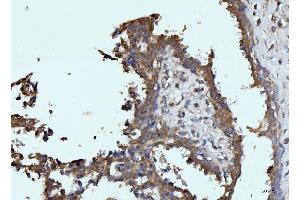 IHC analysis of Glutaminase/GLS using anti-Glutaminase/GLS antibody (ABIN7601601).