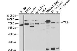Western blot analysis of extracts of various cell lines, using T antibody (ABIN6131955, ABIN6148795, ABIN6148796 and ABIN6221421) at 1:1000 dilution. (TAB1 抗体  (AA 205-504))