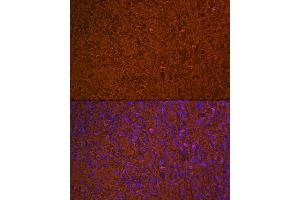 Immunofluorescence analysis of human spleen using Hemoglobin subunit alpha (HB) (HB) Rabbit mAb (ABIN7267608) at dilution of 1:100 (40x lens).