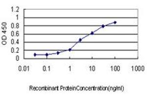 Detection limit for recombinant GST tagged GCK is approximately 0. (GCK 抗体  (AA 356-465))