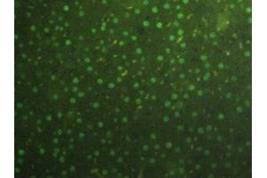 Detection of H3 in Rat Liver Tissue using Polyclonal Antibody to Histone H3 (H3) (Histone 3 抗体  (AA 1-136))