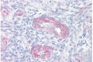 Anti-PLA2G4A antibody IHC staining of human uterus, vessels. (PLA2G4A 抗体  (AA 471-520))