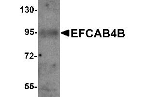 Western Blotting (WB) image for anti-EF-Hand Calcium Binding Domain 4B (EFCAB4B) (C-Term) antibody (ABIN1030378) (EFCAB4B 抗体  (C-Term))