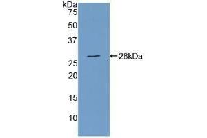 Detection of Recombinant CSE, Human using Polyclonal Antibody to Cystathionine (CTH) (Cystathionine (AA 163-382) 抗体)