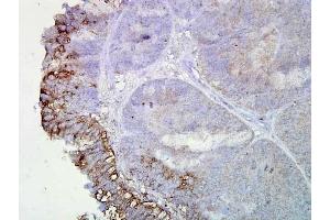 Hsp90 (AC-16), Human Colon Cancer 1 in 2000, Amplifier (HSP90 抗体)