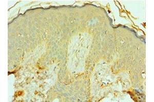 Immunohistochemistry of paraffin-embedded human skin tissue using ABIN7153122 at dilution of 1:100 (FOSL1 抗体  (AA 1-100))