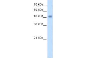 Western Blotting (WB) image for anti-Dihydroorotate Dehydrogenase (DHODH) antibody (ABIN2462489) (DHODH 抗体)