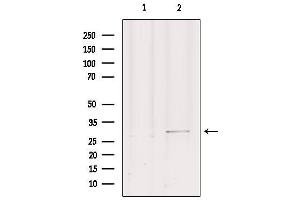 Western blot analysis of extracts from mouse brain, using GEMIN2 Antibody. (SIP1 抗体  (N-Term))
