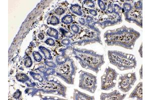 IHC analysis of Cytoglobin using anti- Cytoglobin antibody .