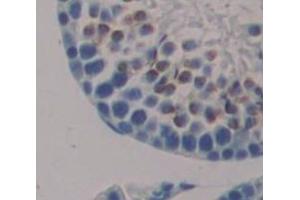 Used in DAB staining on fromalin fixed paraffin- embedded Kidney tissue (Nanog 抗体  (AA 1-305))