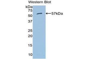 Western Blotting (WB) image for anti-Aldehyde Dehydrogenase 7 Family, Member A1 (ALDH7A1) (AA 28-539) antibody (ABIN1077761) (ALDH7A1 抗体  (AA 28-539))