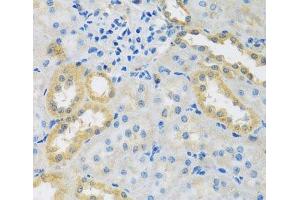 Immunohistochemistry of paraffin-embedded Rat kidney using PMPCB Polyclonal Antibody at dilution of 1:100 (40x lens). (PMPCB 抗体)