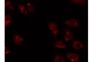 ABIN6274732 staining 293 by IF/ICC. (MRPL16 抗体  (Internal Region))