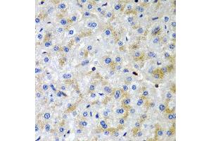 Immunohistochemistry of paraffin-embedded human liver injury using SRGN antibody at dilution of 1:200 (40x lens). (SRGN 抗体)