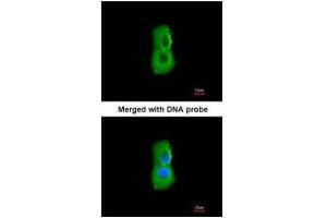 ICC/IF Image Immunofluorescence analysis of paraformaldehyde-fixed A549, using PSMC3, antibody at 1:200 dilution. (PSMC3 抗体)