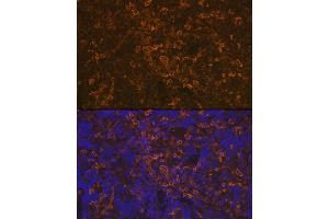Immunofluorescence analysis of rat spleen using LSP1 Rabbit mAb (ABIN7268319) at dilution of 1:100 (40x lens). (LSP1 抗体)